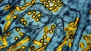 This colorised electron microscope image shows avian influenza A H5N1 virus particles (yellow), grown in Madin-Darby Canine Kidney (MDCK) epithelial cells (blue).