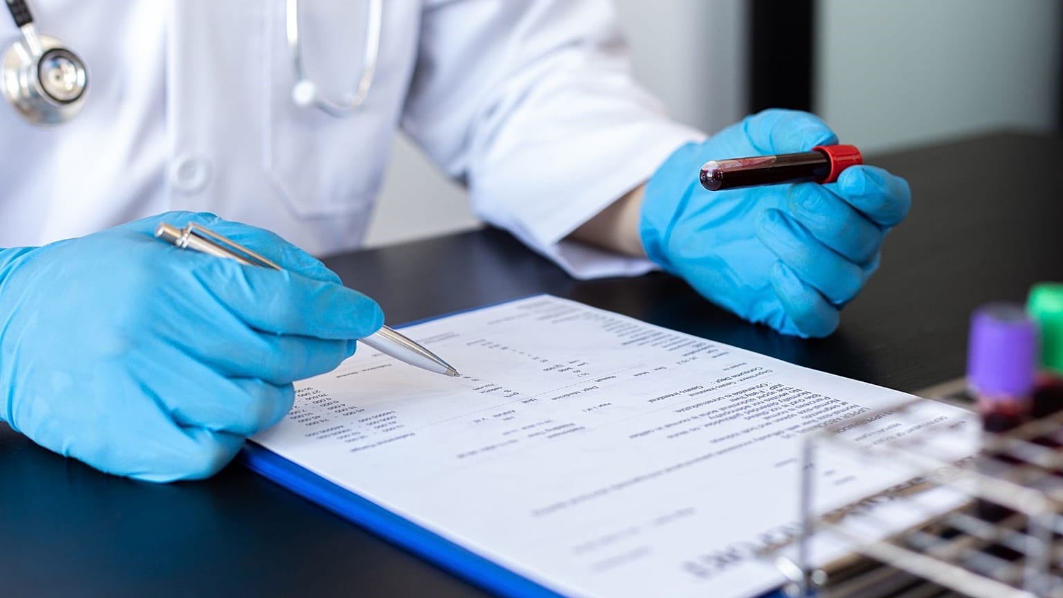 Un médico revisa una muestra de sangre.