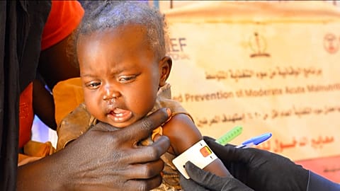 Enfant victime de malnutrition au camp Zamzam, Soudan, le 22.11.2024