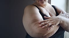 Une femme souffrant d'obésité se tient chez elle.