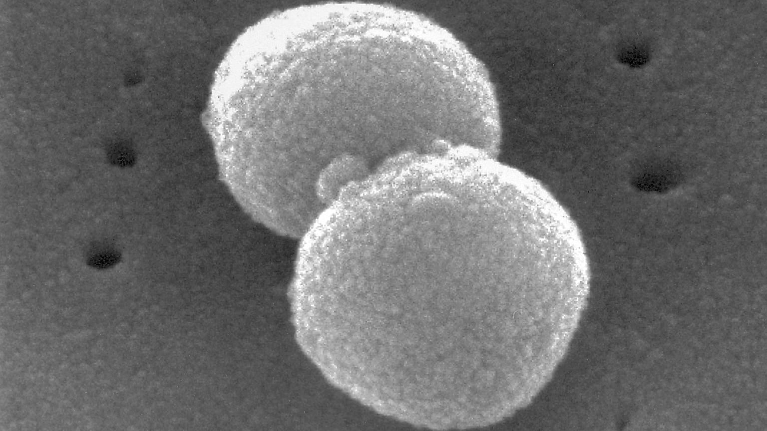 Questa immagine al microscopio elettronico fornita dai Centri per il controllo e la prevenzione delle malattie raffigura due batteri Gram-positivi, Streptococcus pneumoniae