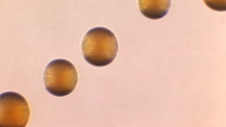 Cette photo prise au microscope en 1966 montre cinq colonies de bactéries du groupe B Neisseria meningitidis.