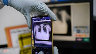 Un trabajador sanitario toma una foto de las radiografías de tórax de un paciente en un hospital de Venezuela en marzo de 2021.