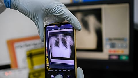 A health worker takes a photo of a patient's chest X-rays at a hospital in Venezuela in March 2021.