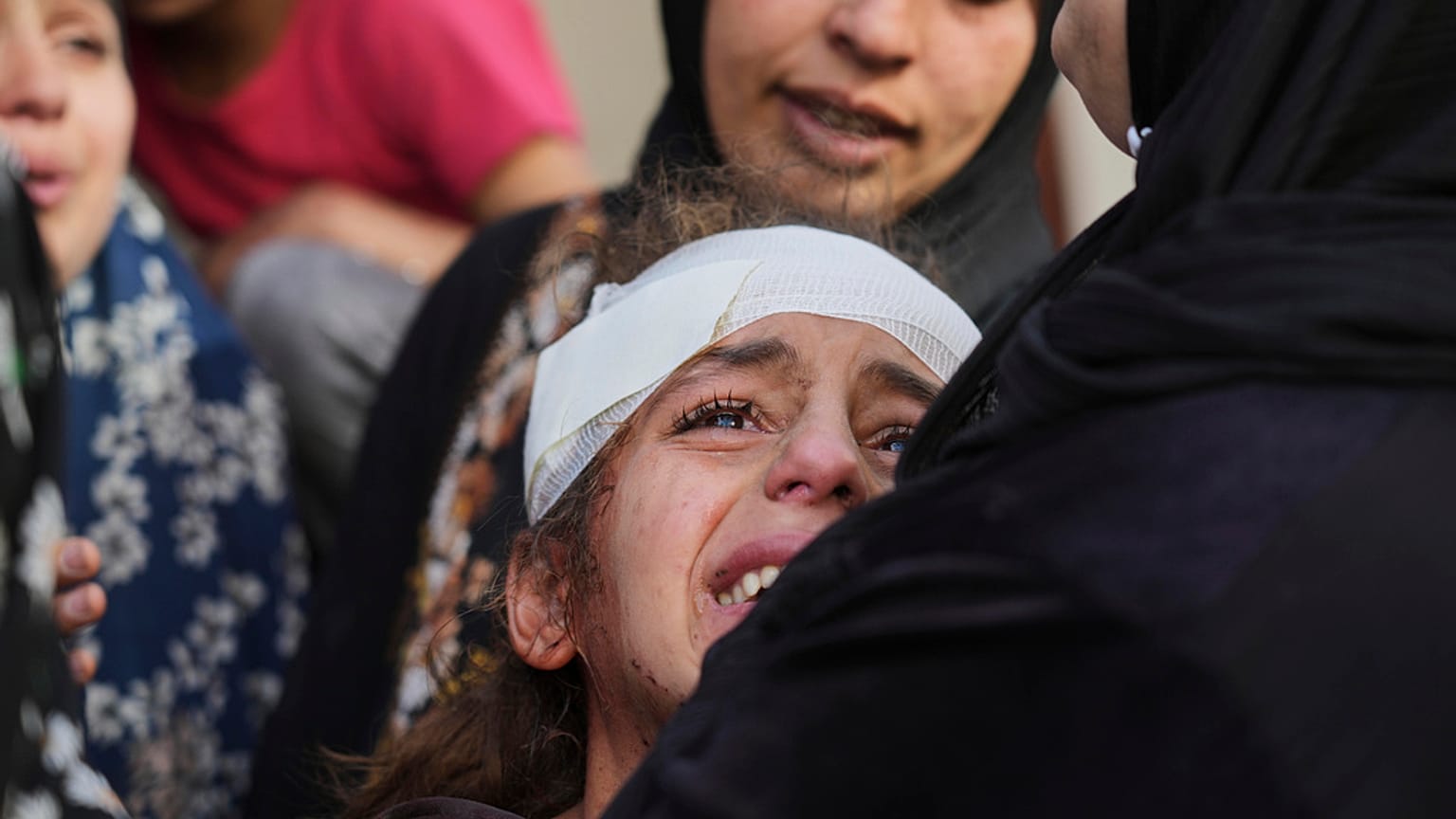 İsrail'in hava saldırısında yaralanan 13 yaşındaki Yamama Jundia, 3 Nisan 2025