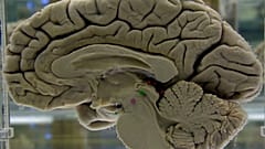Le cerveau humain ne vieillit pas de manière progressive et linéaire, mais qu'un vieillissement soudain se produit à différentes périodes de la vie.