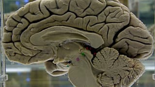 Le cerveau humain ne vieillit pas de manière progressive et linéaire, mais qu'un vieillissement soudain se produit à différentes périodes de la vie.