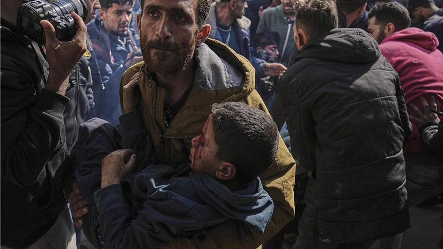 أطفال فلسطينيون أصيبوا في غارة جوية إسرائيلية يتم نقلهم إلى المستشفى المعمداني في مدينة غزة ، السبت 12 أبريل / نيسان 2025.