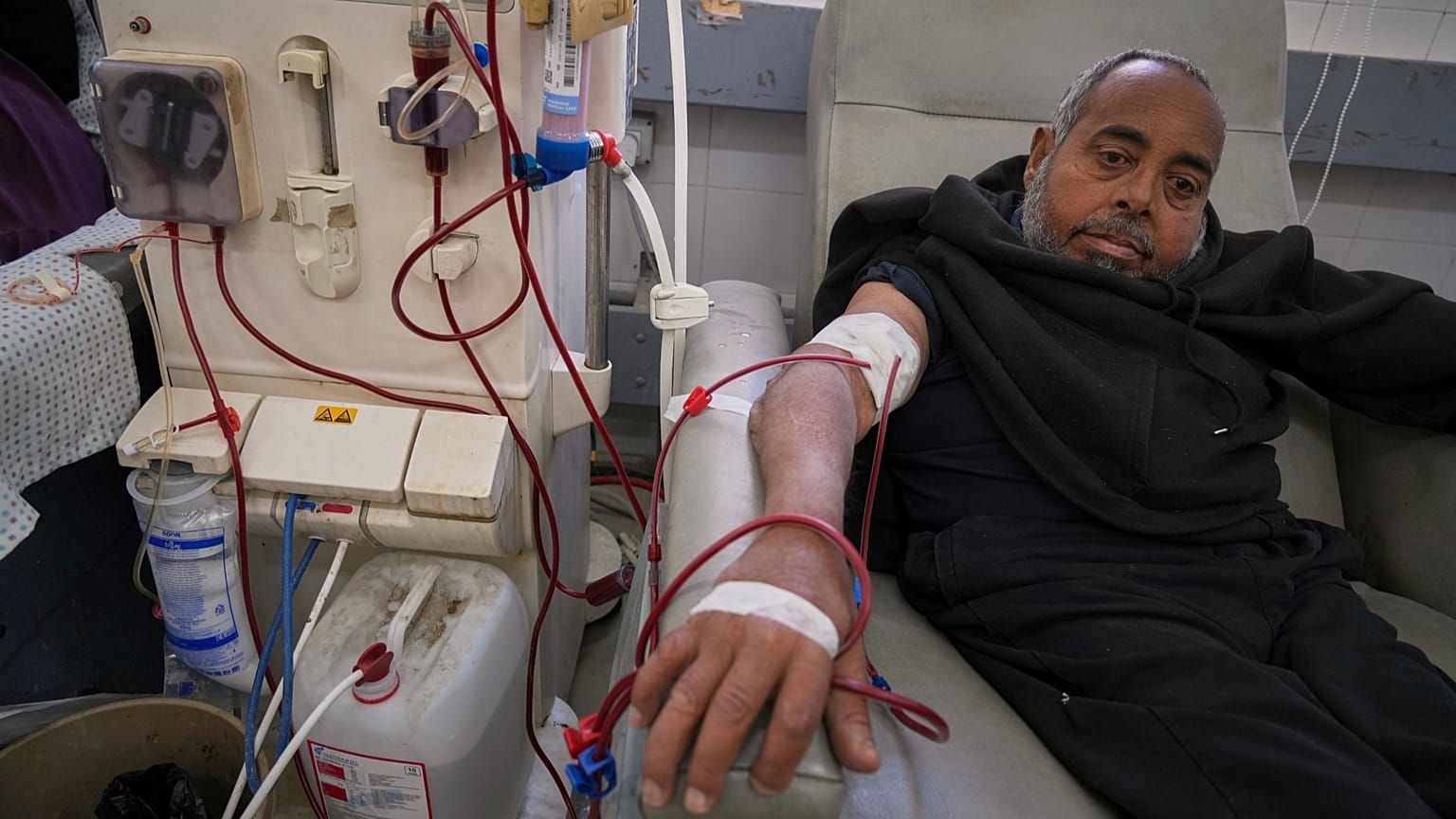 Mohamed Attiya, 54 anos, recebe tratamento de diálise no hospital Shifa, na Cidade de Gaza, segunda-feira, 14 de abril de 2025.