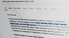 Ένα ερώτημα σχετικά με την υγεία στο Google εμφανίζεται στην οθόνη ενός υπολογιστή τον Απρίλιο του 2025.