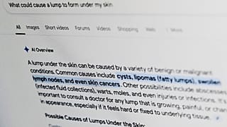 Ένα ερώτημα σχετικά με την υγεία στο Google εμφανίζεται στην οθόνη ενός υπολογιστή τον Απρίλιο του 2025.