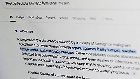 A health-related query on Google is displayed on a computer screen in April 2025.