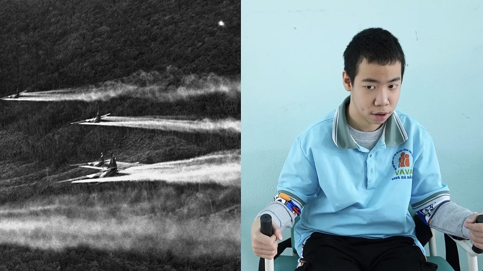 (Izquierda) Los voluminosos "proveedores C-123" rocían defoliante químico sobre Vietnam en 1968. (Derecha) Nguyen Ba Quy Phuoc, de 14 años, asiste a una clase de fisioterapia 