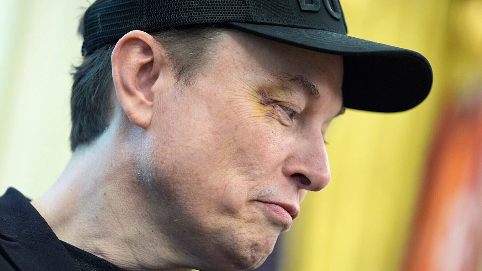 Elon Musk'ın gözündeki morluk şapkasına rağmen belli oluyordu.