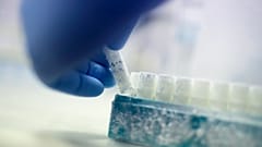 Un científico recoge un vial que contiene muestras congeladas de esperma de donante en un laboratorio de Melbourne, el 15 de mayo de 2018.