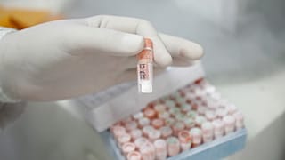  باحث يحمل أنبوب اختبار مملوءًا بالخلايا الجذعية داخل مختبر مركز أبحاث الجينوم البشري بجامعة ساو باولو في ساو باولو، يوم الاثنين، 3 مارس 2008. 
