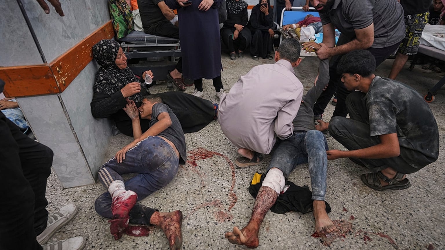 جرحى فلسطينيين في مستشفى الشفاء في مدينة غزة بعد إصابتهم وهم في طريقهم إلى مركز توزيع المساعدات ، الخميس 3 تموز / يوليو 2025
