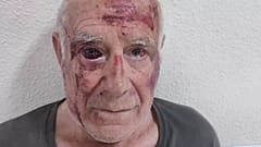 Foto de Domingo, após a agressão de 9 de julho de 2025 em Torre Pacheco, viralizou nas redes.