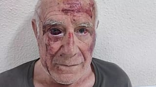 Photo de Domingo, après l'agression du 9 juillet 2025 à Torre Pacheco, viralisée sur les réseaux.