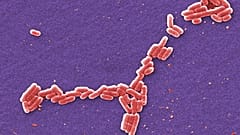 صورة ملوّنة بمجهر إلكتروني لجراثيم E. coli، في نيسان/ أبريل 2006: