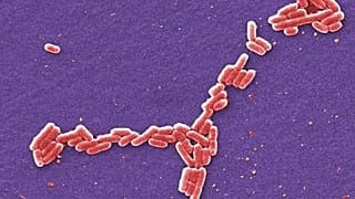 صورة ملوّنة بمجهر إلكتروني لجراثيم E. coli، في نيسان/ أبريل 2006: