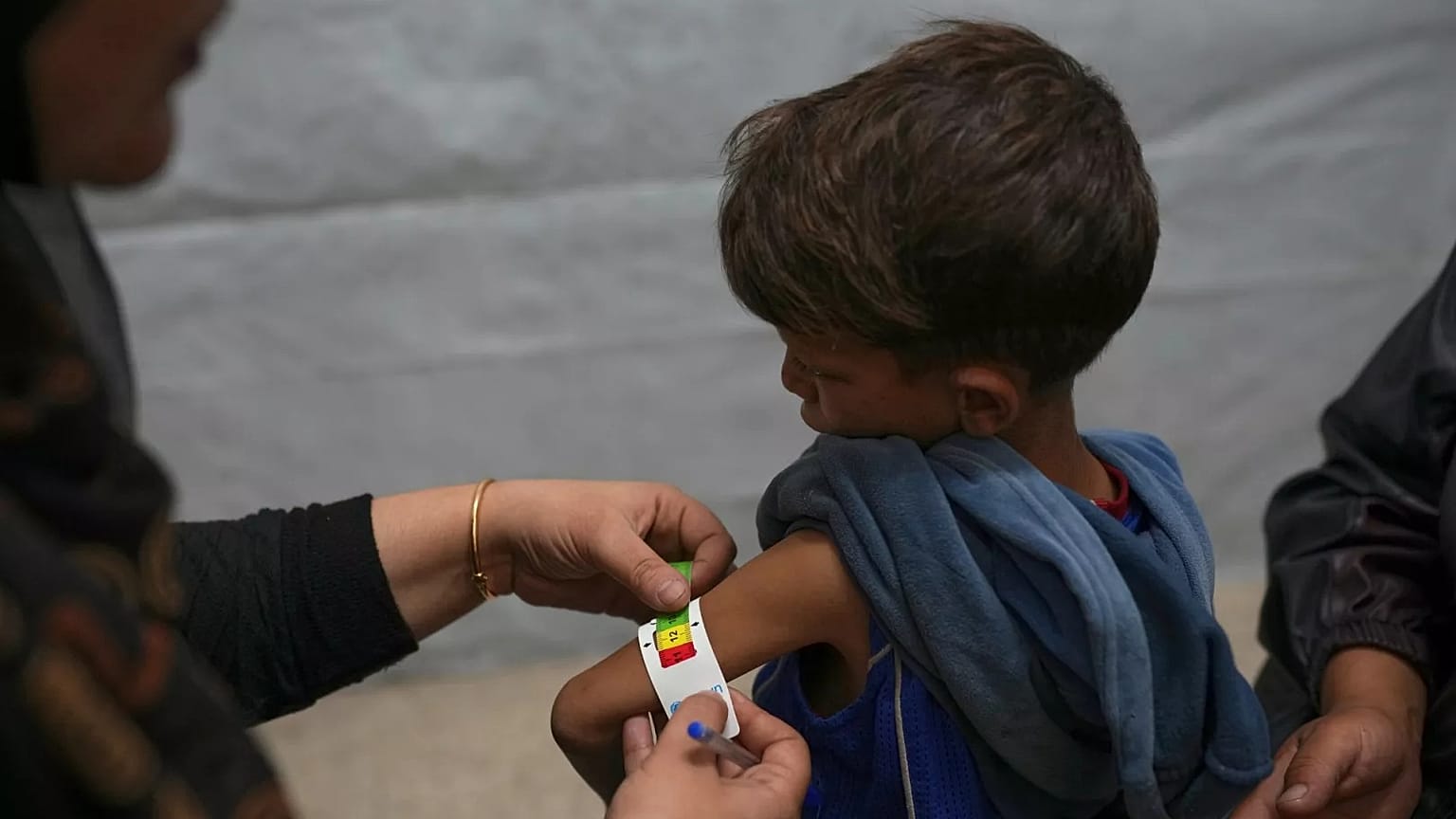 Um menino é examinado por uma enfermeira numa clínica médica na Cidade de Gaza, quarta-feira, 28 de maio de 2025, para detetar sinais de desnutrição.