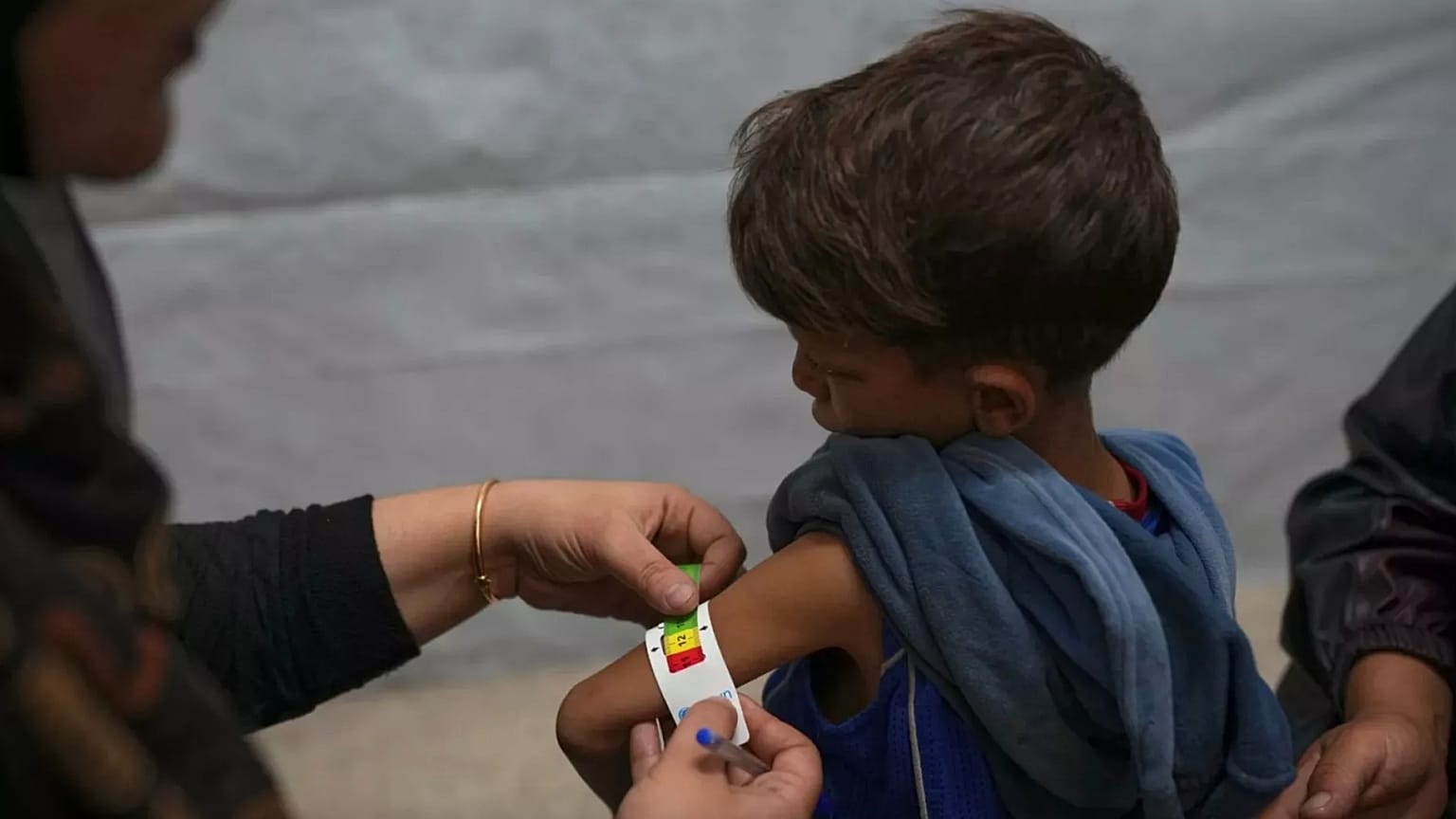 Gazze'deki bir sağlık kliniğinde bir çocuk, hemşire tarafından yetersiz beslenme belirtileri açısından kontrol ediliyor, 28 Mayıs 2025.