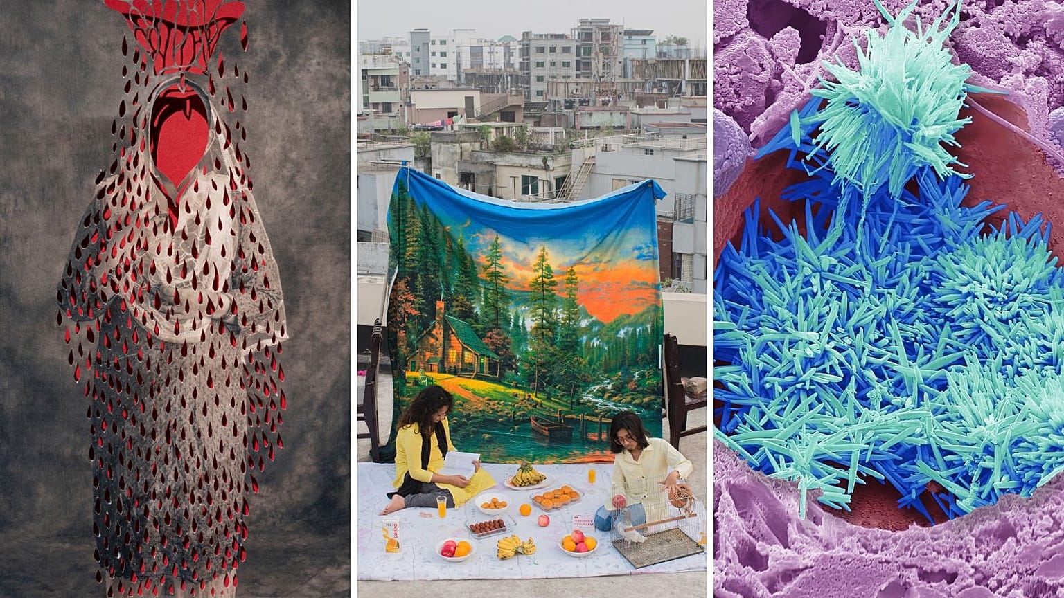 Mil cortes, de Sujata Setia; Viajes urbanos, de Mithail Afrige Chowdhury; El colesterol en el hígado, de Steve Gschmeissner.