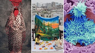 Mil cortes, de Sujata Setia; Viajes urbanos, de Mithail Afrige Chowdhury; El colesterol en el hígado, de Steve Gschmeissner.