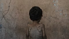 Un niño gazatí, con claros signos de desnutrición, de espaldas.