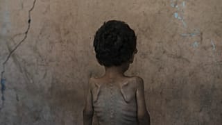 Un niño gazatí, con claros signos de desnutrición, de espaldas.