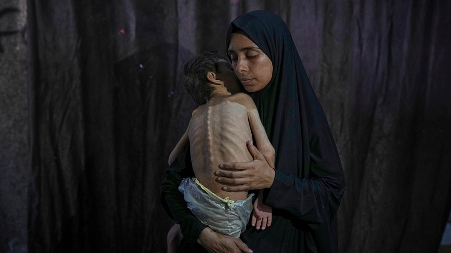 سماح مطر تلتقط صورة مع طفلها الذي يعاني من سوء تغذية وشلل دماغي.
