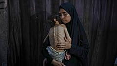 سماح مطر تلتقط صورة مع طفلها الذي يعاني من سوء تغذية وشلل دماغي.