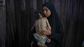 سماح مطر تلتقط صورة مع طفلها الذي يعاني من سوء تغذية وشلل دماغي.