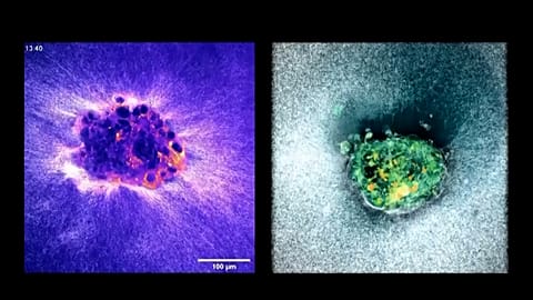 A human embryo burrowing into a lab created uterus.