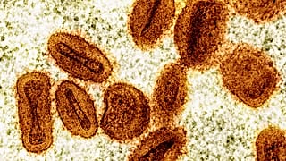 جزيئات فيروس جدري القرود (mpox) باللون البرتقالي داخل خلايا مصابة باللون الأخضر