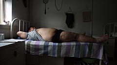 Bir hasta, Çin'in Tianjin kentindeki Aimin Obezite Yardım Hastanesi'nde akupunktur tedavisinde, 25 Temmuz 2008
