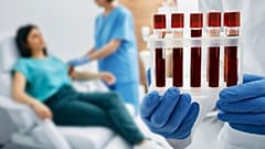 Μια απλή εξέταση αίματος θα μπορούσε να μεταμορφώσει τη διάγνωση της νόσου του Alzheimer σε μια νέα βρετανική δοκιμή