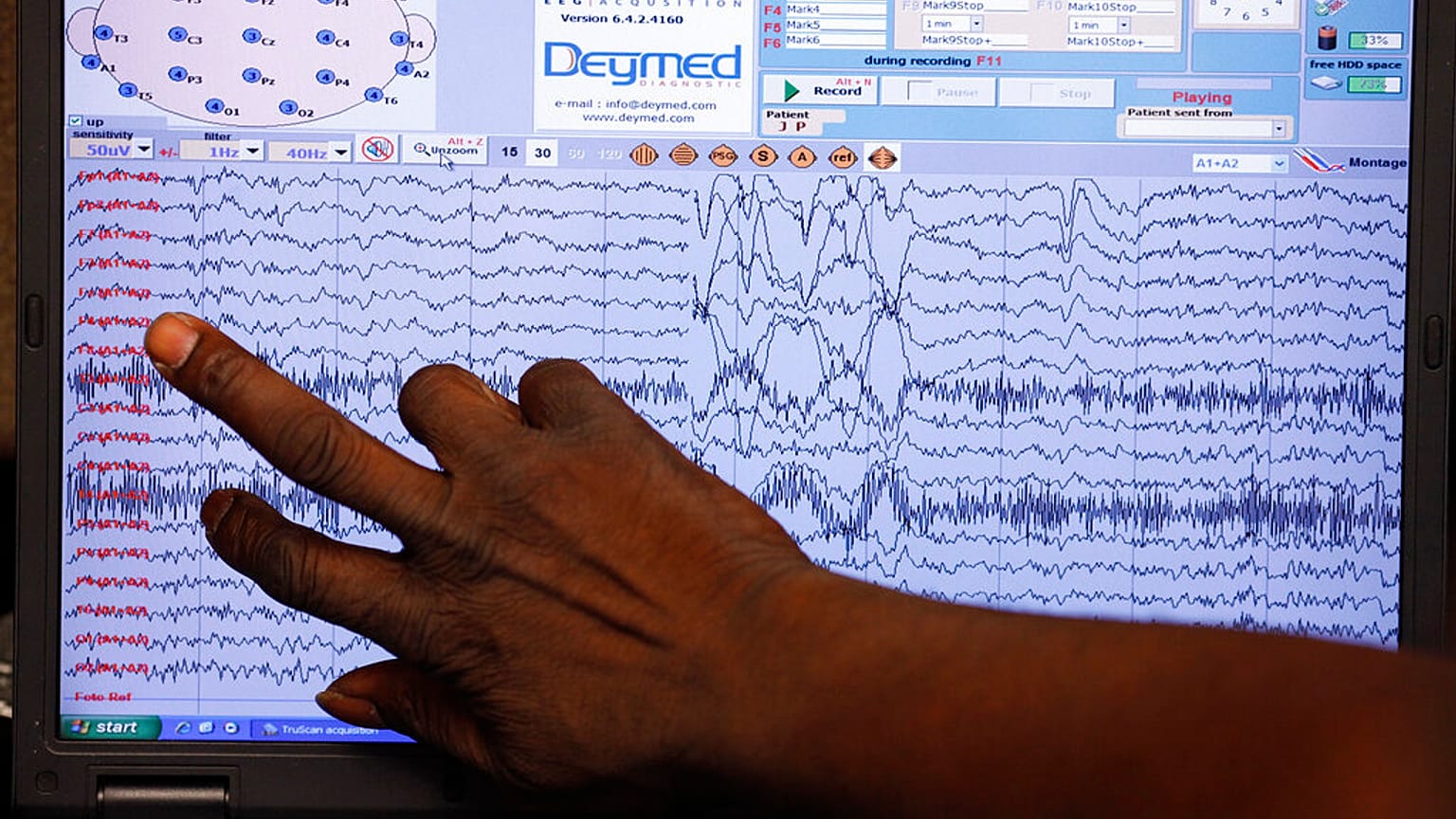 في هذه الصورة الملتقطة في 3 يونيو/حزيران 2010 بولاية كنتاكي، يقرأ الممرض العملي المرخص آرثر غيتس موجات الدماغ.
