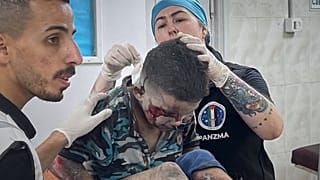 Sérült gyerek egy gázai kórházban