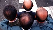 صورة من الأرشيف- أربع رجال في روما يعرضون تفاوت تساقط شعرهم