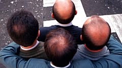 صورة من الأرشيف- أربع رجال في روما يعرضون تفاوت تساقط شعرهم