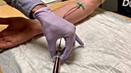 A clinical researcher draws blood from a study participant at Oregon Health & Science University's Knight Cancer Institute in Portland, 14 March, 2022