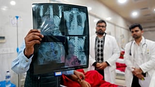 صورة تعبيرية لأطباء يفحصون صورة بالأشعة السينية أثناء علاج مصاب في مستشفى موتيلال نهرو في براياجراج، الهند