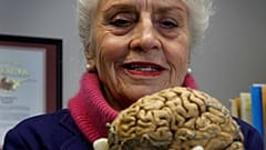 صورة تعبيرية لأستاذة التشريح ماريان دايموند تحمل دماغًا بشريًا في مكتبها بجامعة كاليفورنيا