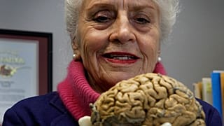 صورة تعبيرية لأستاذة التشريح ماريان دايموند تحمل دماغًا بشريًا في مكتبها بجامعة كاليفورنيا