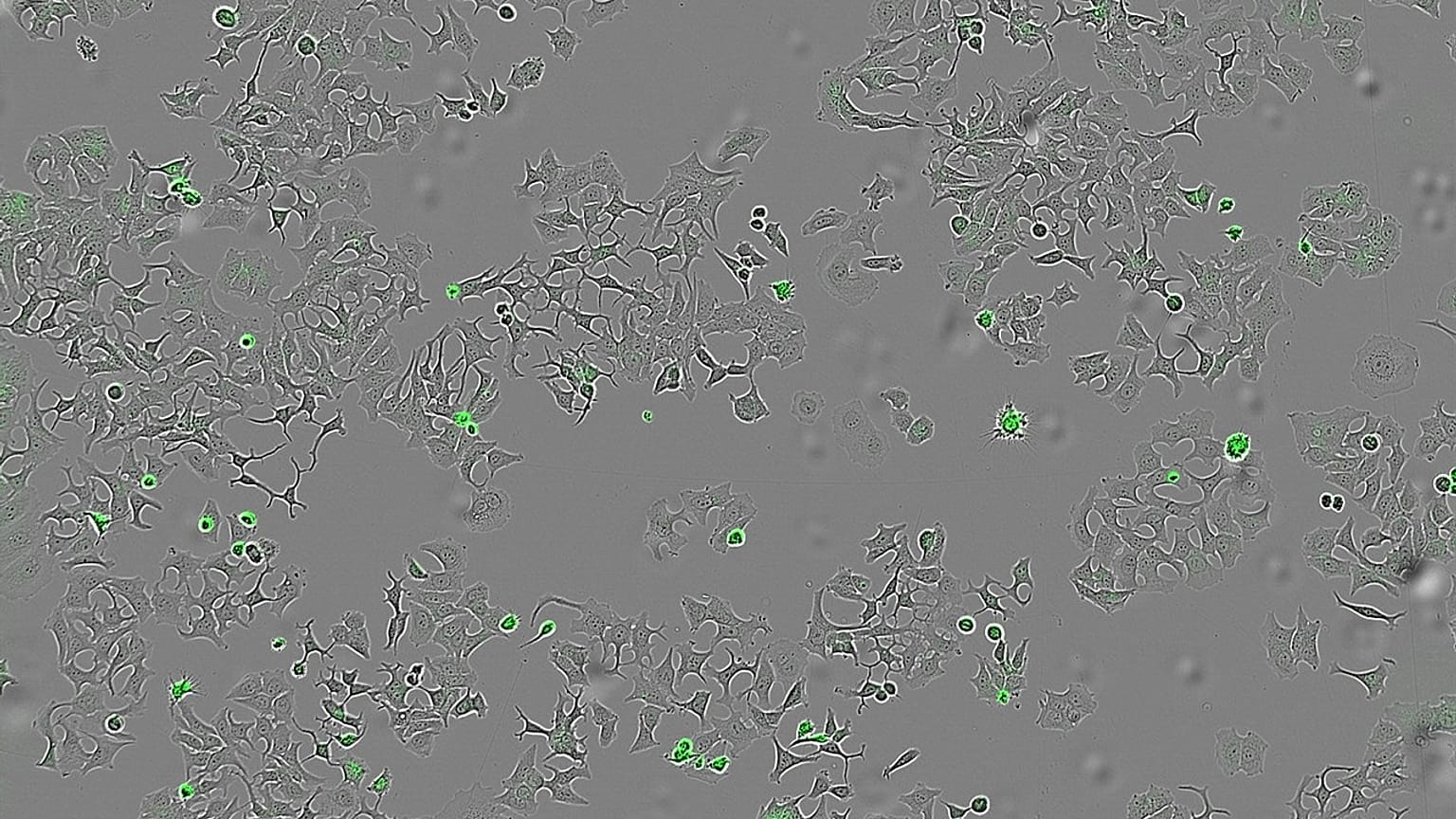 Imagen de células tumorales atacadas por la bacteria del cólera