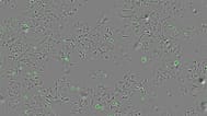 Imagen de células tumorales atacadas por la bacteria del cólera