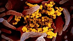 Coronavirus SARS-CoV-2