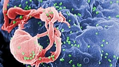 صورة ميكروسكوبية إلكترونية ماسحة لعدة نتوءات دائرية لفيروس HIV-1 على سطح خلية